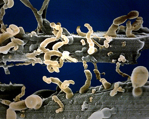 Figura 1: colonias de nanobios “a color”. Cortesía Dra. Philippa Uwins, The Queensland University of Australia, and The Centre for Microscopy and Microanalysis.