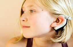 El vértigo como complicación del implante coclear