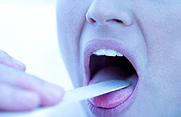 Extirpación quirúrgica de amígdalas no propicia la obesidad