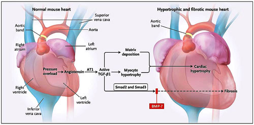 Figura 1: hipertrofia cardíaca y fibrosis en un modelo de ratón