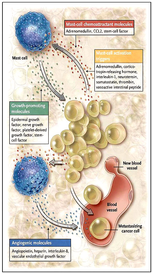 Figura 1: mastocitos en el cáncer de páncreas