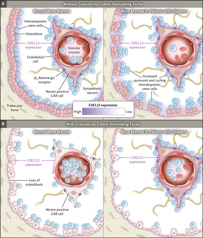 Figura 1: movilización de células madre hematopoyéticas en la médula ósea de pacientes con diabetes