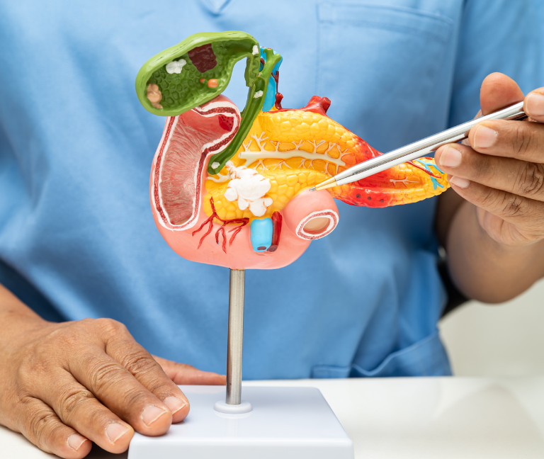 Erradicación de H. Pylori protegería contra cáncer pancreático