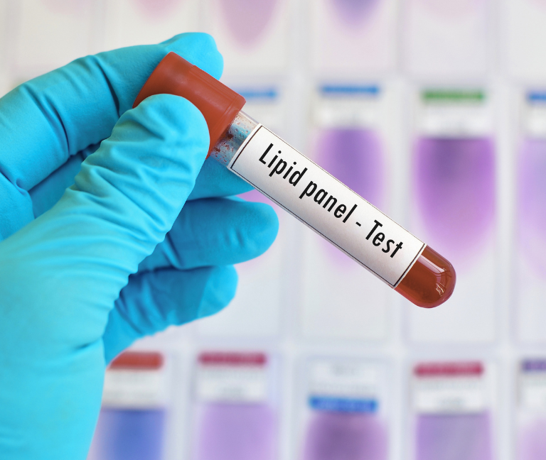 Guía de dislipidemia 2026: más allá del colesterol LDL