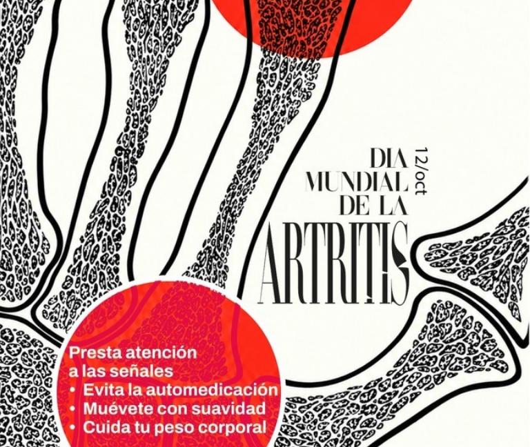 Detección precoz marca la diferencia en el manejo de la artritis
