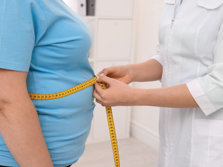 obesidad, sobrepeso, cáncer, agonistas de GLP-1, cirugía bariátrica