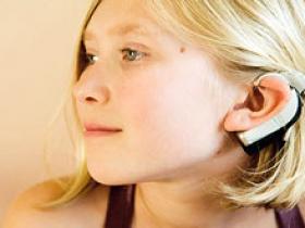 El vértigo como complicación del implante coclear