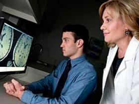 Estimulación cerebral profunda alivia el Síndrome de Tourette