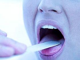 Extirpación quirúrgica de amígdalas no propicia la obesidad