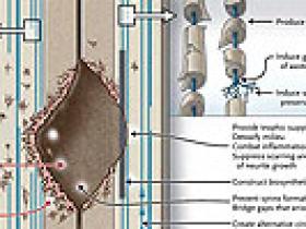 Células dentales para tratar lesiones de la médula