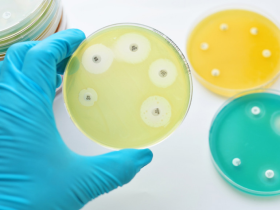 Fortalecimiento al sistema de vigilancia de resistencia antimicrobiana