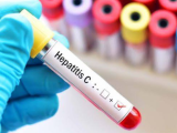 Día Mundial contra la Hepatitis Viral, cirrosis y carcinoma hepatocelular