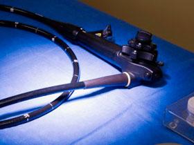 Colonoscopia de cribado prolonga la supervivencia