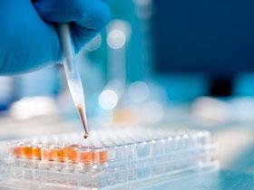 miR-21 diagnóstica y pronostica el cáncer colorrectal