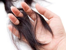 Los macrófagos contribuyen a controlar la calvicie