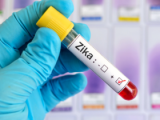 Técnica cromatográfica permite rápida detección del Zika