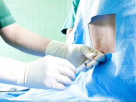 Agujas atraumáticas disminuyen incidencia de cefalea post punción dural