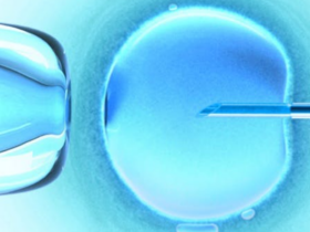 Elasticidad celular predice características tumorales