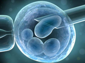 Ovulación inducida en mujeres con ovario poliquístico