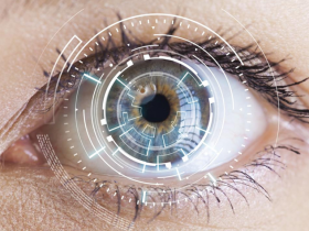 Diagnóstico de Alzheimer por angiografía OCT 