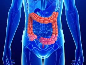 Ustekinumab atenúa manifestaciones histológicas 