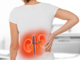 Inhibidores de la aldosterona sintasa contra la enfermedad renal