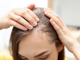 salud capilar, vitamina d, hierro, alopecia, perdida de cabello, encanecimiento prematuro