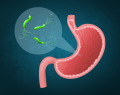 Helicobacter pylori, tratamiento para Helicobacter pylori, H. pylori, erradicación de H. pylori, terapia cuádruple con bismuto