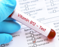 deficiencia de vitamina B12, hipovitaminosis B12, neuropatía periférica, metformina, uso crónico de metformina, uso de metformina a largo plazo, diabetes tipo 2