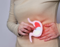 dispepsia funcional, trastornos de la interacción intestino-cerebro, tratamiento de la dispepsia funcional, diagnóstico de la dispepsia funcional, síntomas de la dispepsia funcional, antiácidos, simeticona