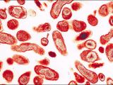 Coxiella burnetii: responsable de la fiebre Q