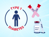 Nuevo paradigma en el abordaje de la diabetes tipo 1