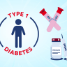 Nuevo paradigma en el abordaje de la diabetes tipo 1