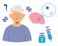 enfermedad de Alzheimer, alzheimer, donanemab