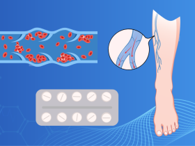 anticoagulantes orales directos, apixabán, rivaroxabán, tromboembolismo venoso, embolia pulmonar aguda, trombosis venosa profunda proximal