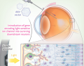 optogenética, terapia optogenética directa, retinitis pigmentosa, ceguera, ceguera avanzada