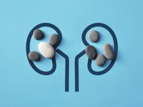 bacterias, cálculos renales, investigación